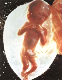 embrione a quattro  mesi di gestazione